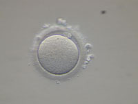 Яйцеклетка перед оплодотворением